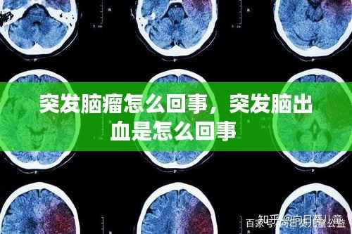 突发脑瘤怎么回事,突发脑出血是怎么回事