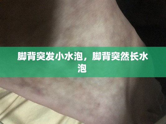 脚背突发小水泡,脚背突然长水泡